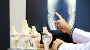 doctor pointing at knee bones
